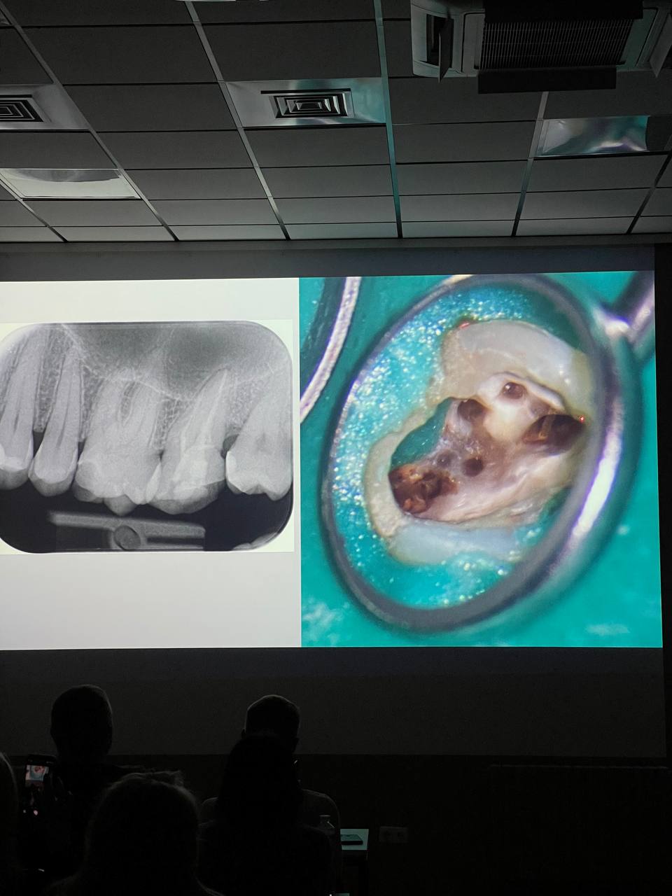 IMAGE 2024 06 11 21 10 43 — Sofi Dental